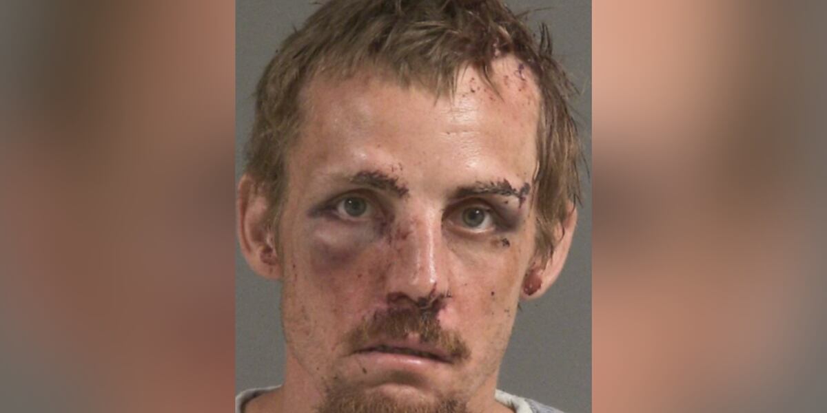 Armed robber sent to hospital with head and face injuries after ...